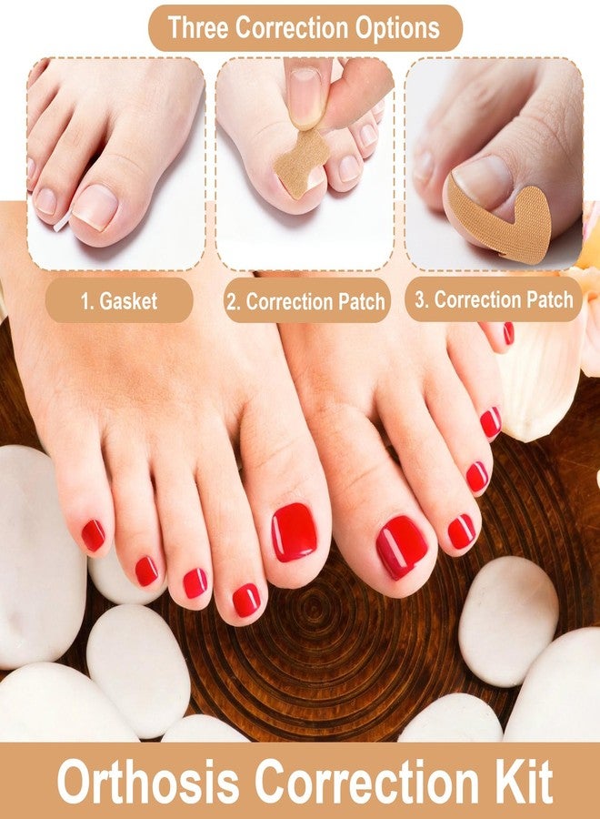 Penitue 16pcs Ingrown Toenail Straighten Set with Breathable Ingrowing Toenail Strips, Professional Pedicure Nail Tool Removal Kit with Clippers File Lifter Cuticle Tools for Men Women Toenails Maintenance - Image 4